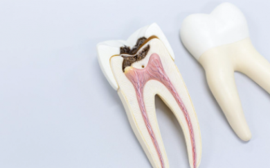 Endodonti Tedavileri